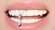 Veneers: Everything You Need to Know