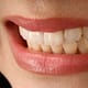 Veneers: Everything You Need to Know